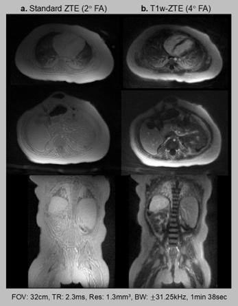 Quiet MRI image 2
